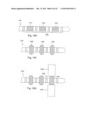 ANCHORING UNITS FOR LEADS OF IMPLANTABLE ELECTRIC STIMULATION SYSTEMS AND     METHODS OF MAKING AND USING diagram and image