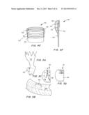 Means for Controlled Sealing of Endovascular Devices diagram and image