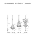 Means for Controlled Sealing of Endovascular Devices diagram and image