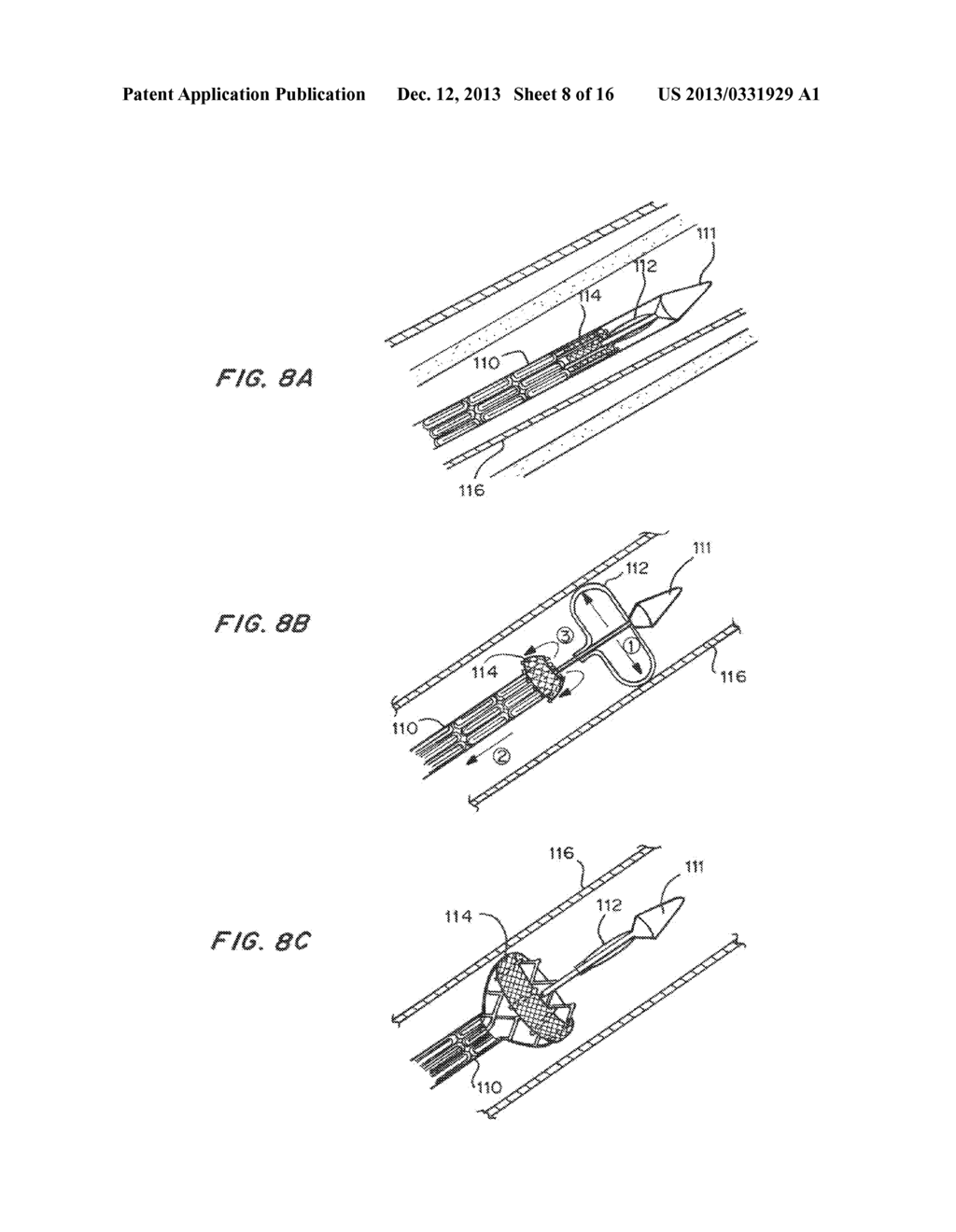 Means for Controlled Sealing of Endovascular Devices - diagram, schematic, and image 09