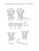 Means for Controlled Sealing of Endovascular Devices diagram and image