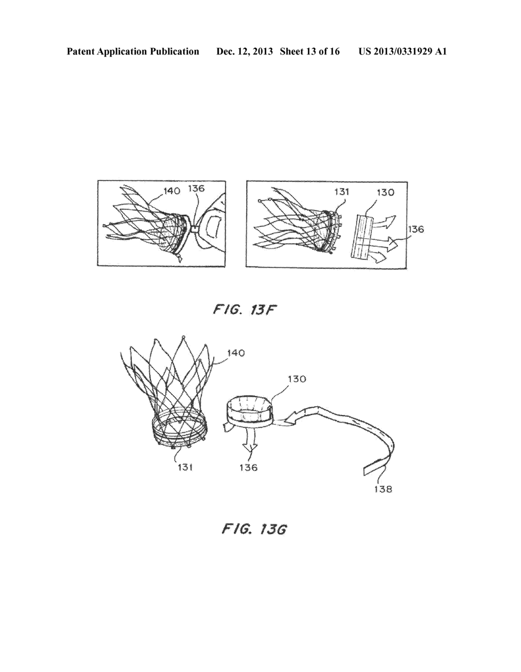 Means for Controlled Sealing of Endovascular Devices - diagram, schematic, and image 14