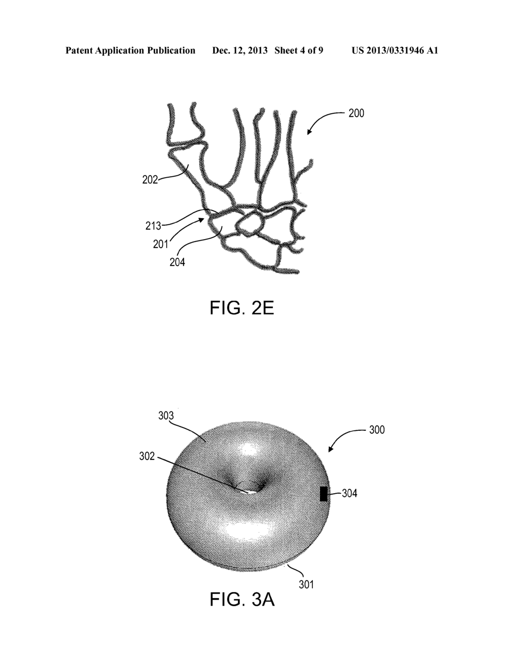 EXPANDABLE JOINT IMPLANT - diagram, schematic, and image 05