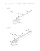 URETERAL STENT diagram and image