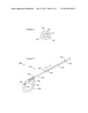 URETERAL STENT diagram and image