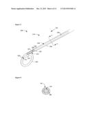 URETERAL STENT diagram and image