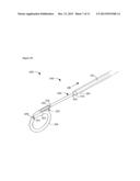 URETERAL STENT diagram and image