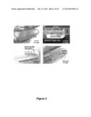 Appendage Mountable Electronic Devices COnformable to Surfaces diagram and image