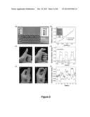 Appendage Mountable Electronic Devices COnformable to Surfaces diagram and image