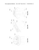 PRESSURE EQUALIZATION APPARATUS FOR A BOTTLE AND METHODS ASSOCIATED     THEREWITH diagram and image