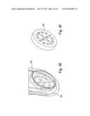 METHOD FOR CONNECTING TWO COMPONENTS OF A VEHICLE SEAT diagram and image