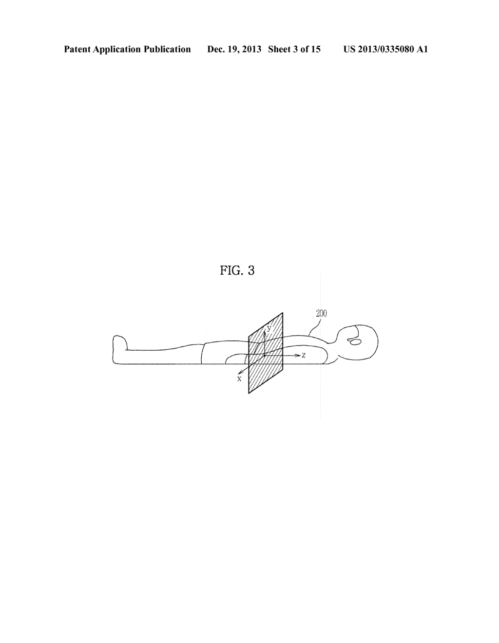 RESONANCE IMAGING APPARATUS AND DIFFUSION WEIGHTED IMAGE ACQUIRING METHOD     THEREOF - diagram, schematic, and image 04