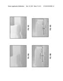 REMOVAL OF MOLYBDENUM diagram and image