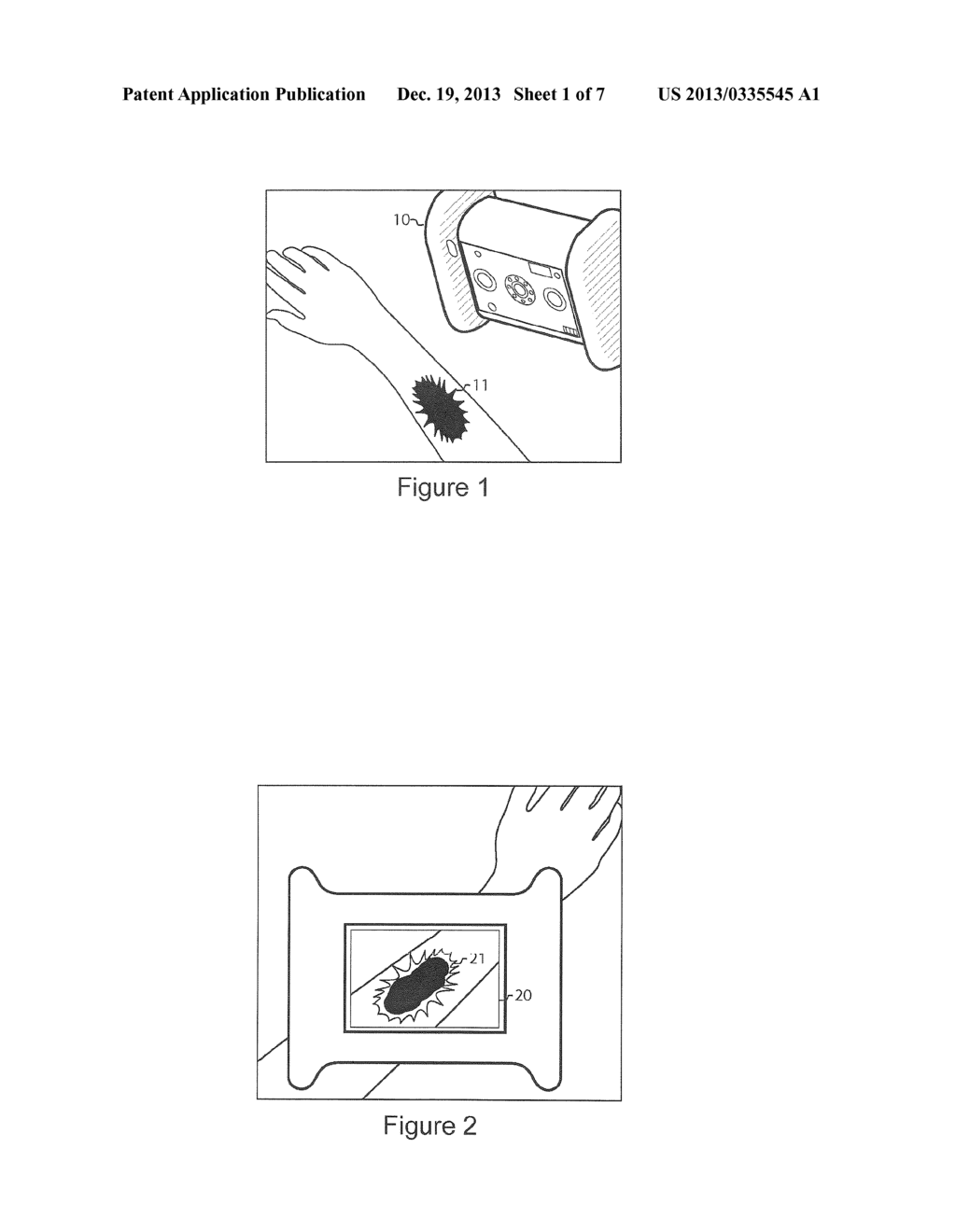 SYSTEM FOR INTEGRATED WOUND ANALYSIS - diagram, schematic, and image 02