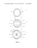 Dynamically Variable Graphic Material Using Electrostatically Attracted     Particles diagram and image