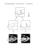 DETECTION OF ANATOMICAL LANDMARKS diagram and image