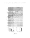 NANOPARTICLE AND METHOD FOR DETECTING OR TREATING A TUMOR USING THE SAME diagram and image