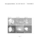 FOLATE TARGETED ENHANCED TUMOR AND FOLATE RECEPTOR POSITIVE TISSUE OPTICAL     IMAGING TECHNOLOGY diagram and image