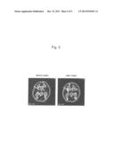 MEANS AND METHODS FOR ACTIVATING VAGUS NERVE diagram and image