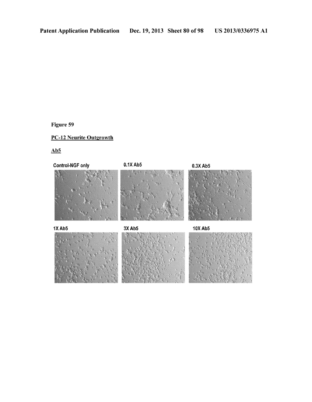 ANTI-NGF COMPOSITIONS AND USE THEREOF - diagram, schematic, and image 81