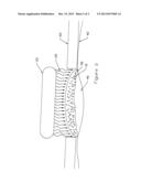 SILICON NANOPARTICLEFOR PHOTODYNAMIC CANCER TREATMENT UTILIZING QUANTUM     DOT OPTICAL PROPERTIES diagram and image