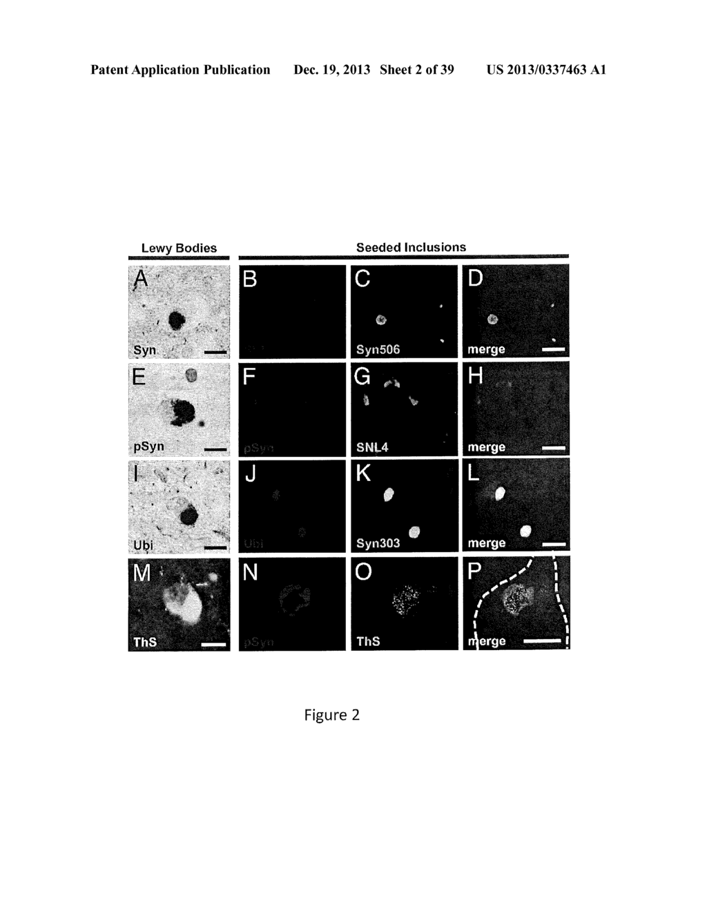 Cell-Based Models of Neurodegenerative Disease - diagram, schematic, and image 03