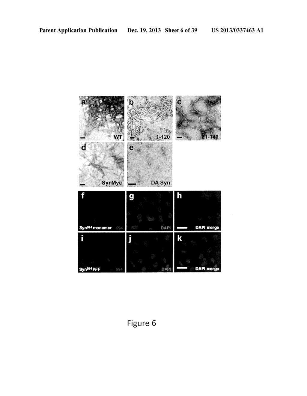 Cell-Based Models of Neurodegenerative Disease - diagram, schematic, and image 07