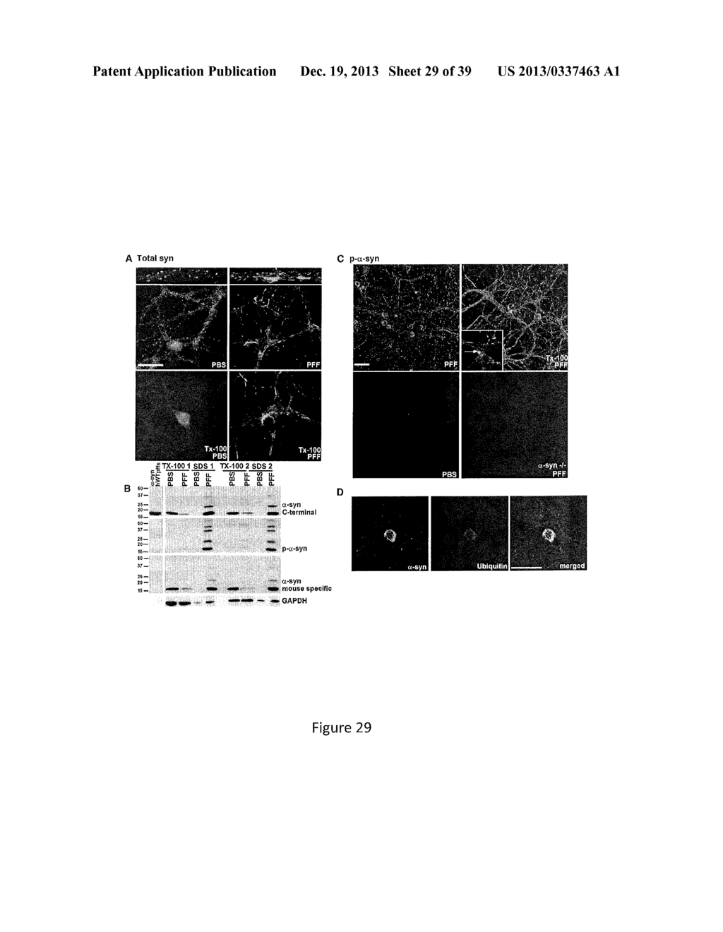 Cell-Based Models of Neurodegenerative Disease - diagram, schematic, and image 30