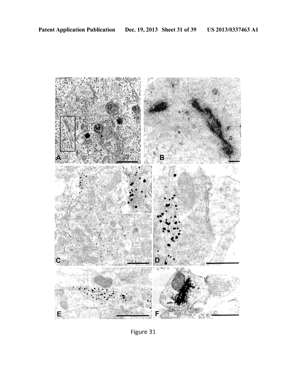 Cell-Based Models of Neurodegenerative Disease - diagram, schematic, and image 32