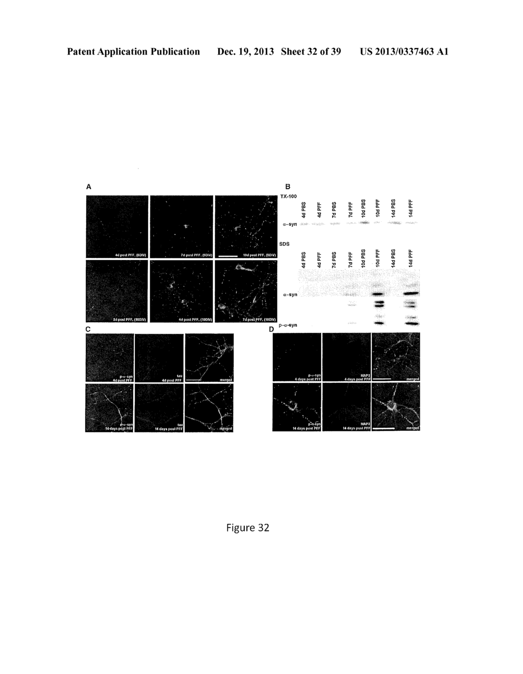 Cell-Based Models of Neurodegenerative Disease - diagram, schematic, and image 33