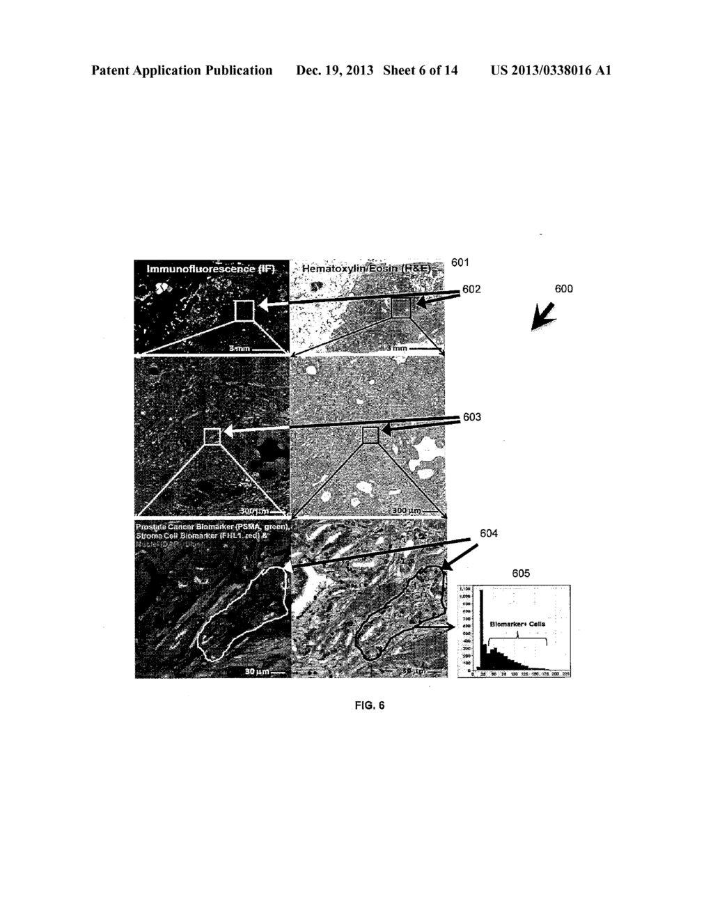 Method For Integrated Pathology Diagnosis And Digital Biomarker Pattern     Analysis - diagram, schematic, and image 07