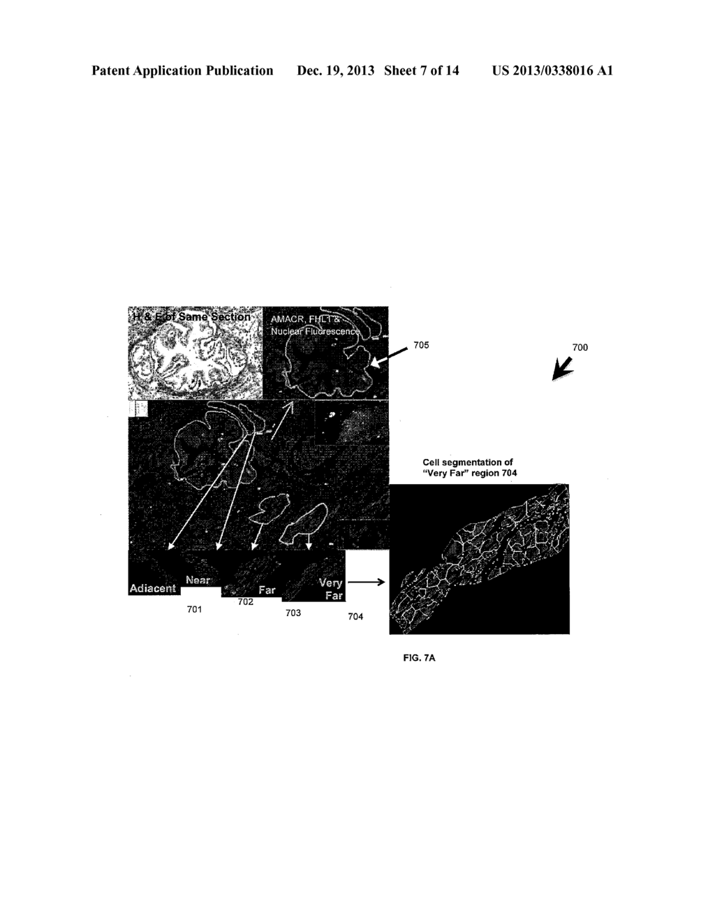 Method For Integrated Pathology Diagnosis And Digital Biomarker Pattern     Analysis - diagram, schematic, and image 08