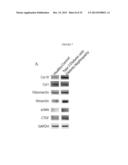 METHODS AND COMPOSITIONS FOR THE DETECTION OF COMPLICATIONS OF DIABETES diagram and image