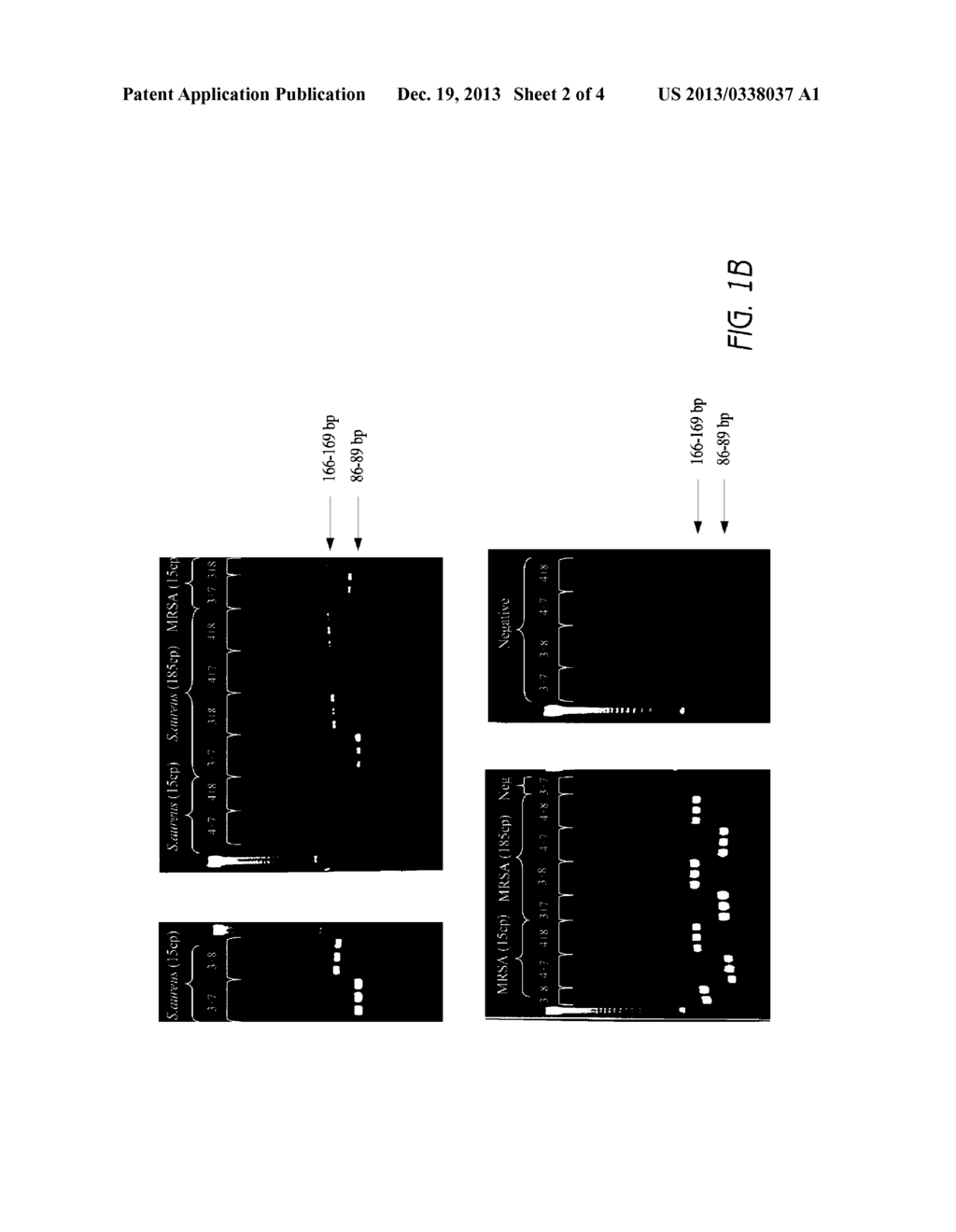 DETECTION OF STAPHYLOCOCCUS AUREUS AND IDENTIFICATION OF     METHICILLIN-RESISTANT STAPHYLOCOCCUS AUREUS - diagram, schematic, and image 03