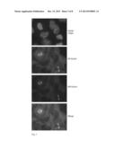 HUMAN BetaV-TUBULIN ANTIBODY AND METHODS OF USE diagram and image