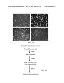 COMPOUNDS AND METHODS FOR TARGETING LEUKEMIC STEM CELLS diagram and image