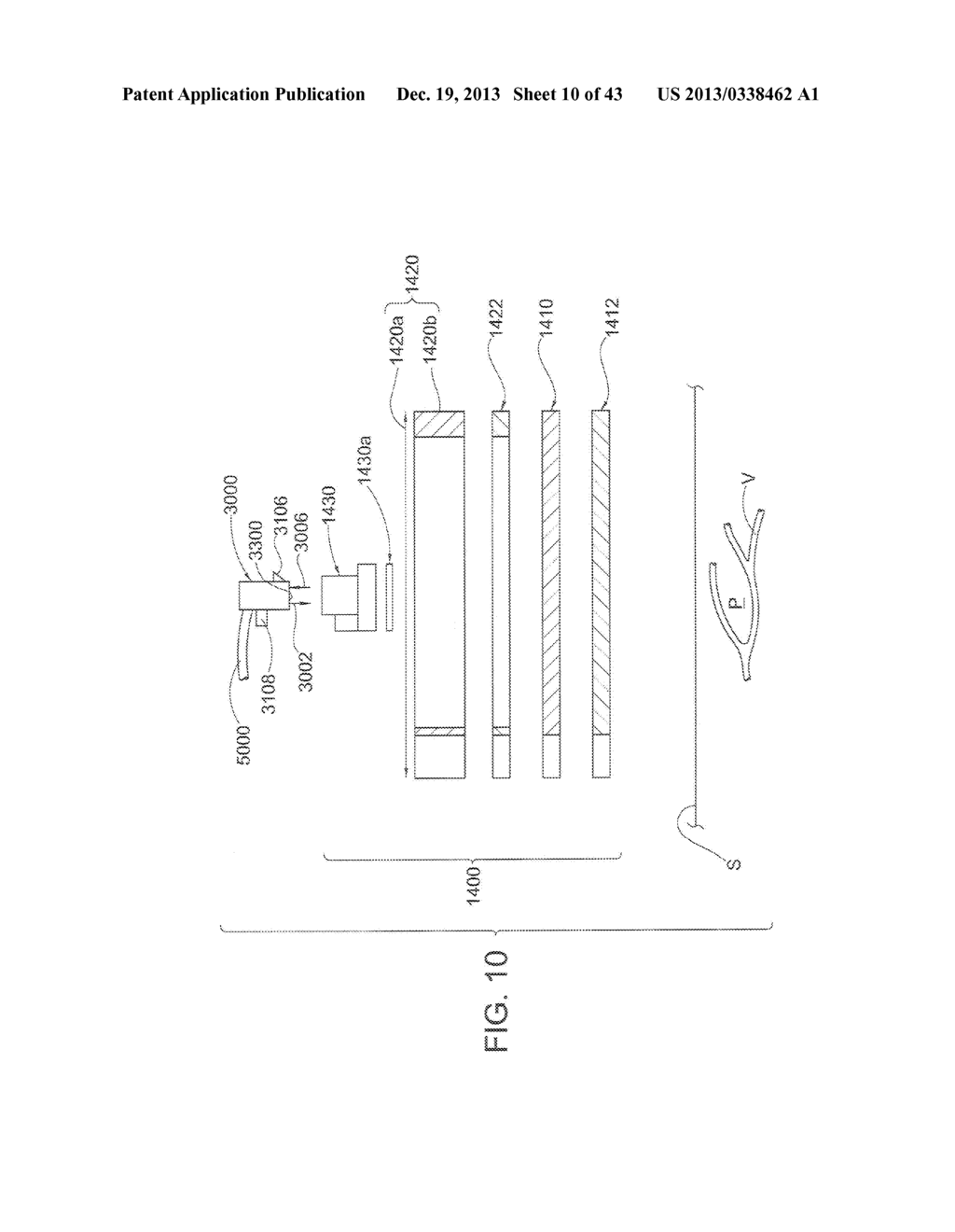 System for Mitigating the Effects of Tissue Blood Volume Changes to Aid in     Diagnosing Infiltration or Extravasation in Animalia Tissue - diagram, schematic, and image 11