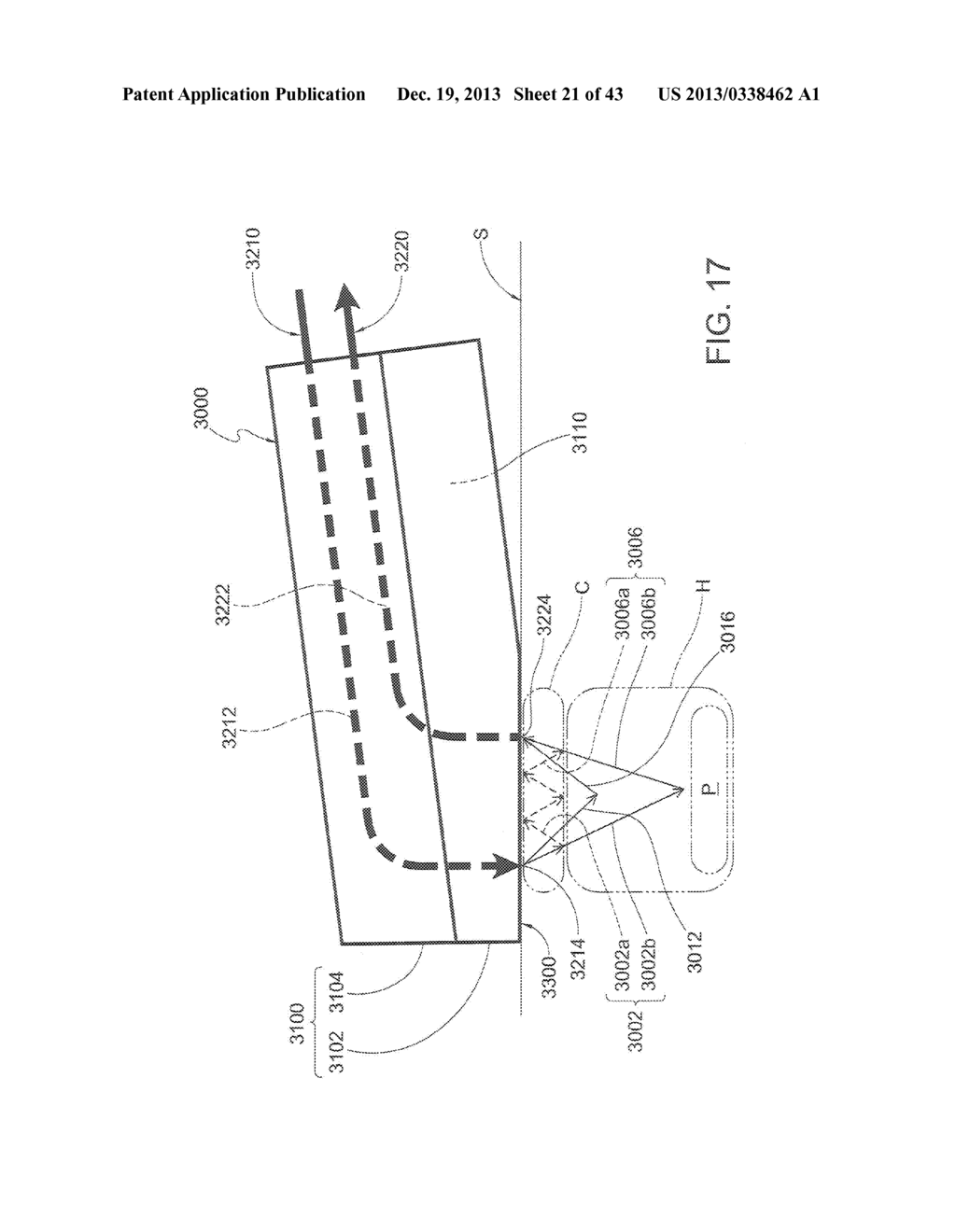 System for Mitigating the Effects of Tissue Blood Volume Changes to Aid in     Diagnosing Infiltration or Extravasation in Animalia Tissue - diagram, schematic, and image 22