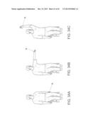 System for Mitigating the Effects of Tissue Blood Volume Changes to Aid in     Diagnosing Infiltration or Extravasation in Animalia Tissue diagram and image