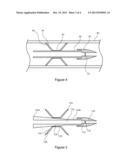 IMPLANTABLE OCCLUDER OR FILTER diagram and image