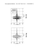 SYSTEM AND METHOD FOR NON-INVASIVE INSTANTANEOUS AND CONTINUOUS     MEASUREMENT OF CARDIAC CHAMBER VOLUME diagram and image