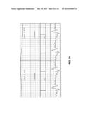 SYSTEM AND METHOD FOR NON-INVASIVE INSTANTANEOUS AND CONTINUOUS     MEASUREMENT OF CARDIAC CHAMBER VOLUME diagram and image