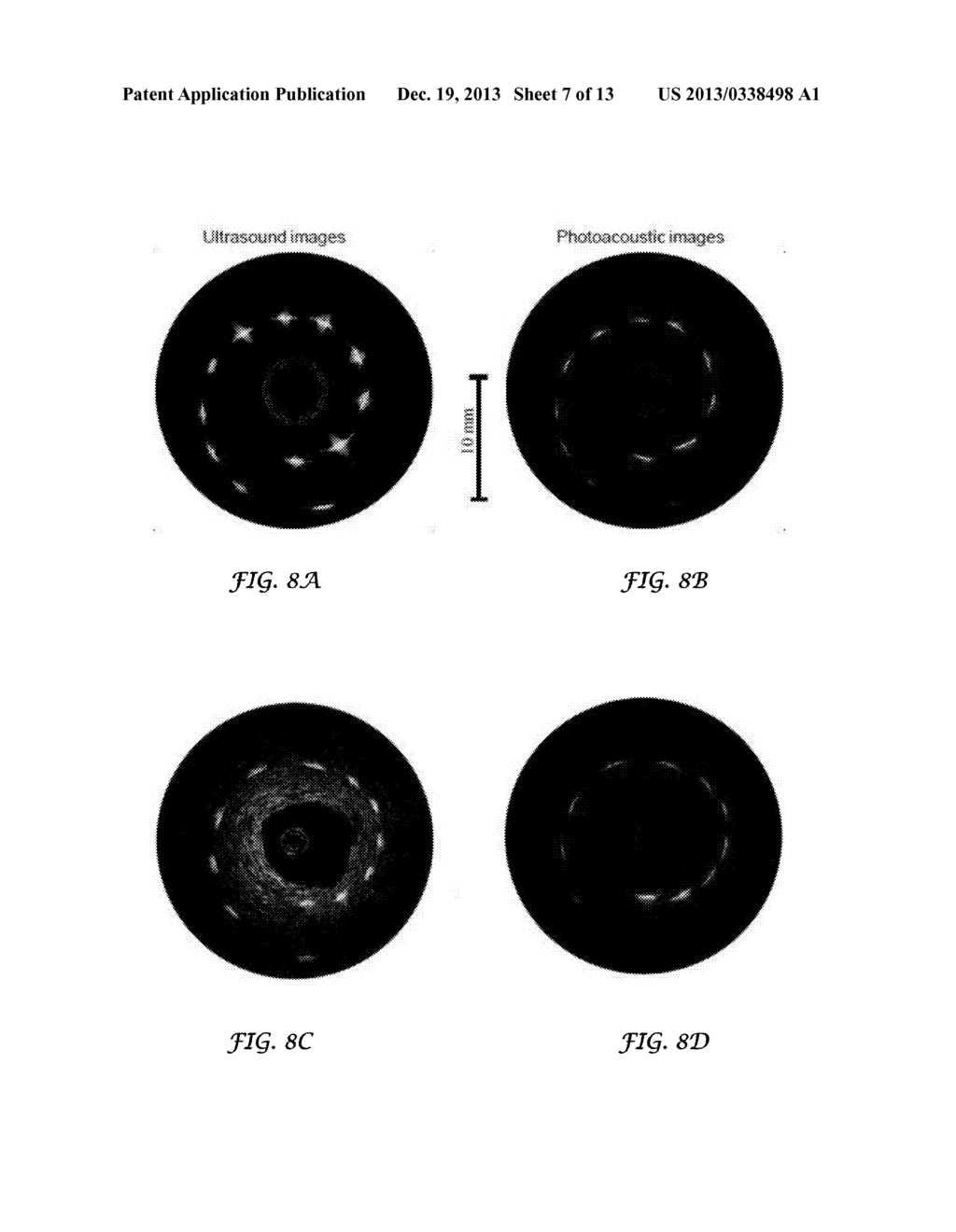 Catheter for Intravascular Ultrasound and Photoacoustic Imaging - diagram, schematic, and image 08