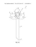 NASAL TUBE DEVICE AND METHOD diagram and image