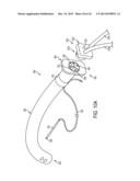 NASAL TUBE DEVICE AND METHOD diagram and image