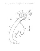NASAL TUBE DEVICE AND METHOD diagram and image