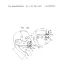 ENDOSCOPIC BITE BLOCK diagram and image