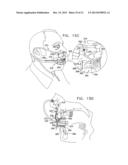 ENDOSCOPIC BITE BLOCK diagram and image