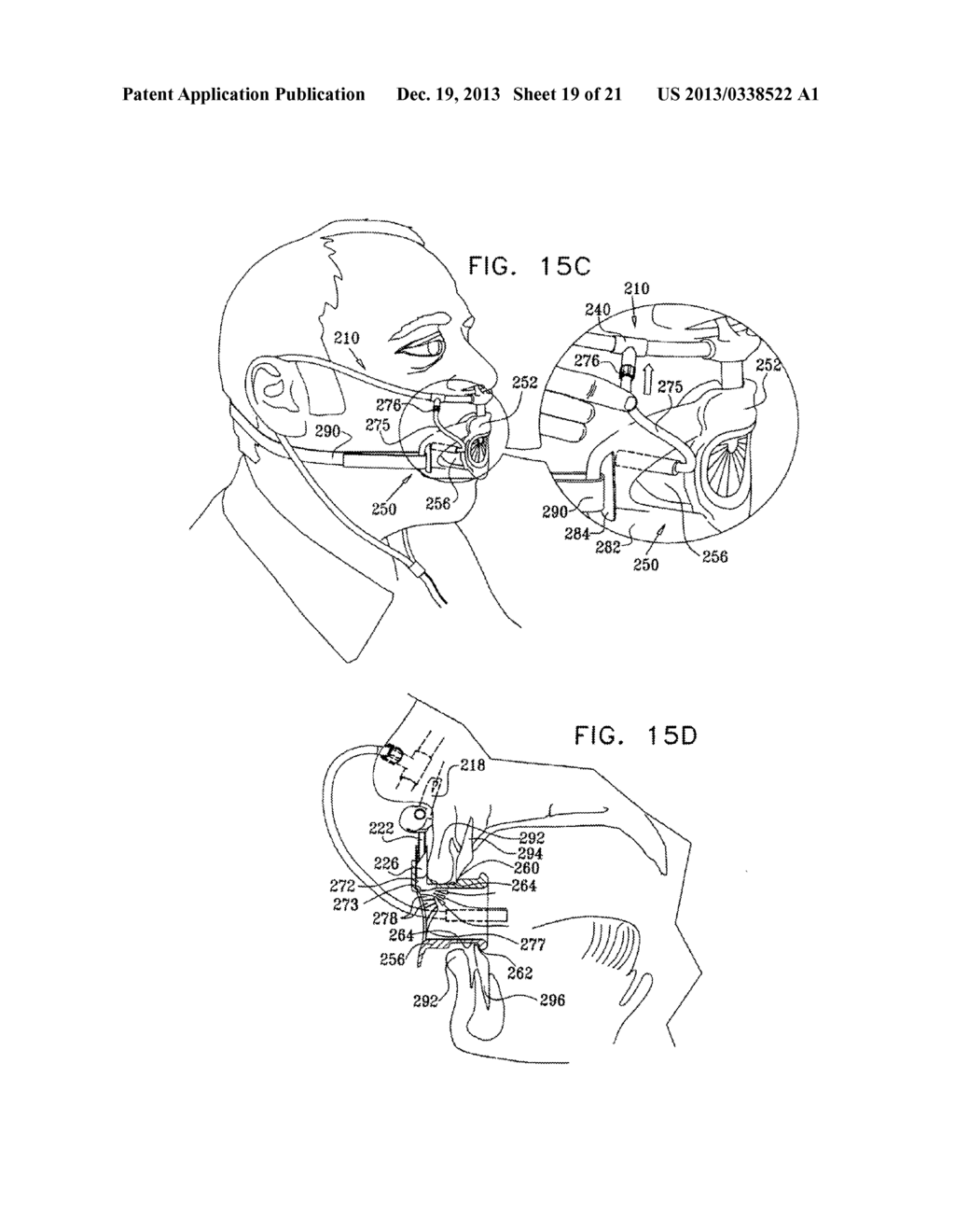 ENDOSCOPIC BITE BLOCK - diagram, schematic, and image 20