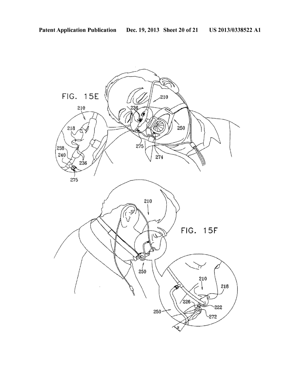 ENDOSCOPIC BITE BLOCK - diagram, schematic, and image 21